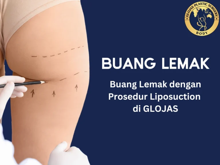 buang lemak klinik, - buang lemak malaysia - buang lemak glojas