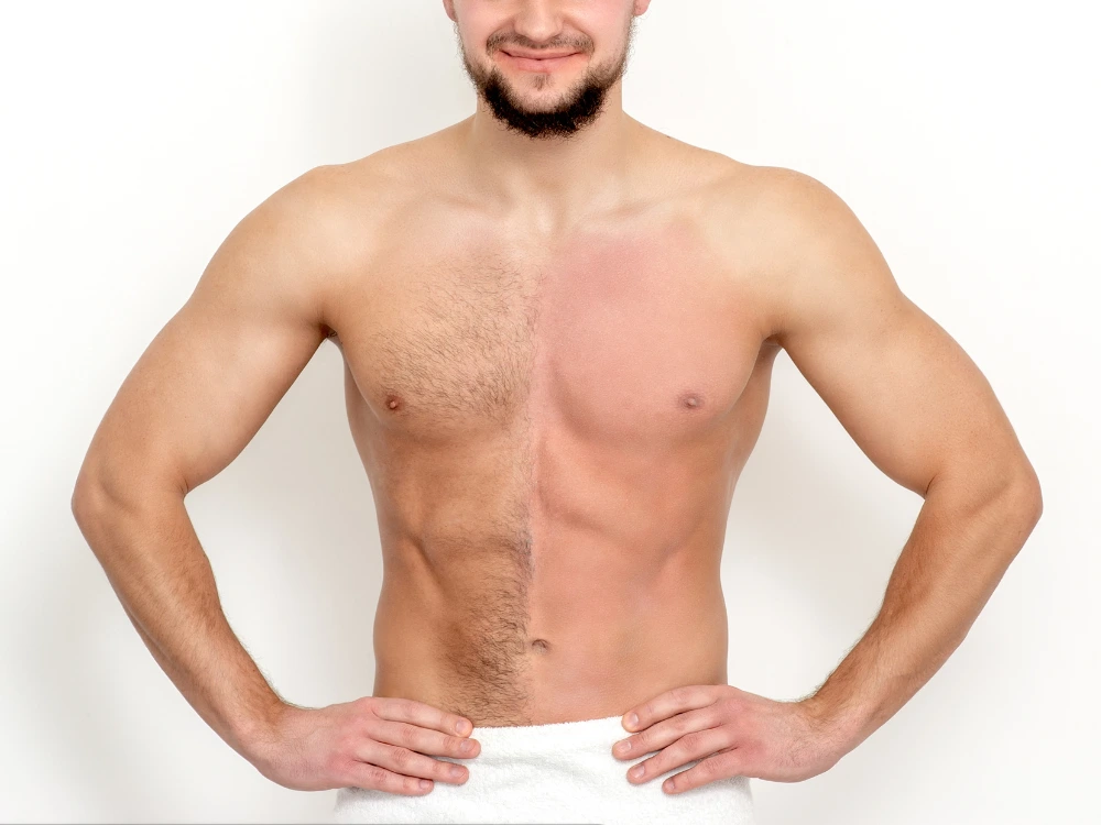 chest-hair-transplant-malaysia