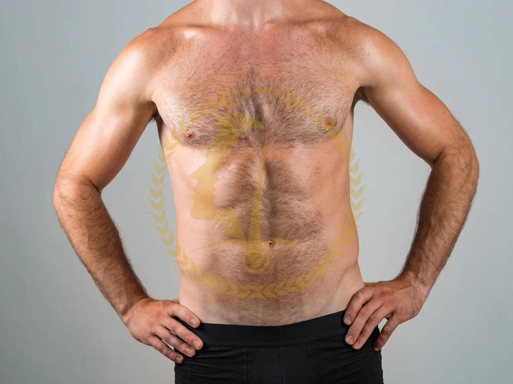 gynecomastia