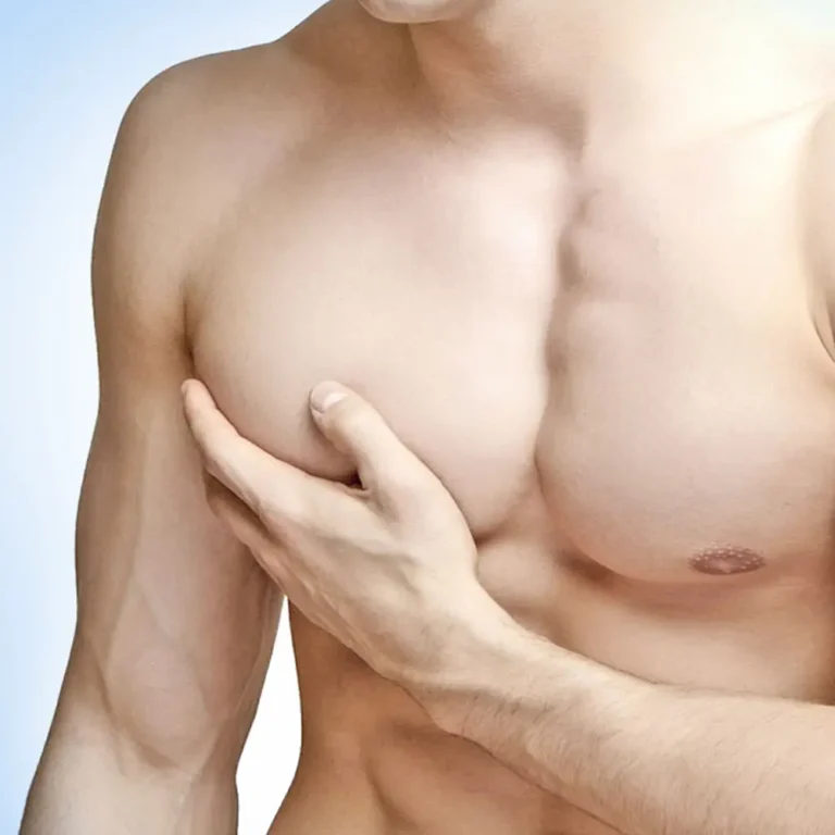 gynecomastia-malaysia