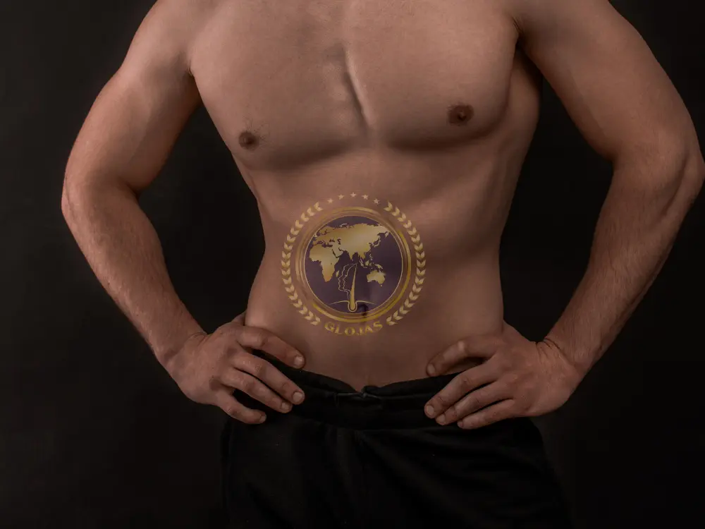 gynecomastia-stages