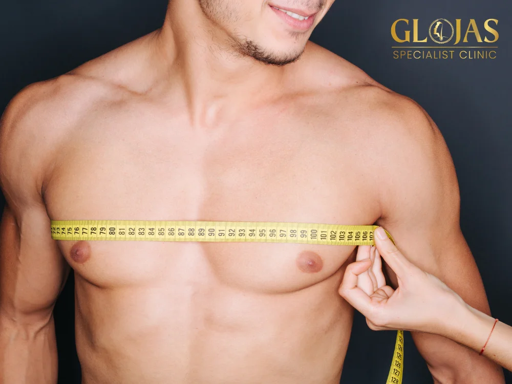 gynecomastia