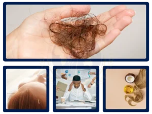 hair-loss-treatment-hair-loss-type-malaysia-glojas