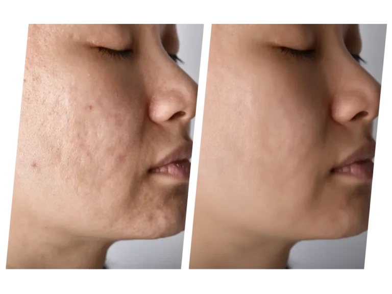 uneven skin pigmentation aesthetic specialist