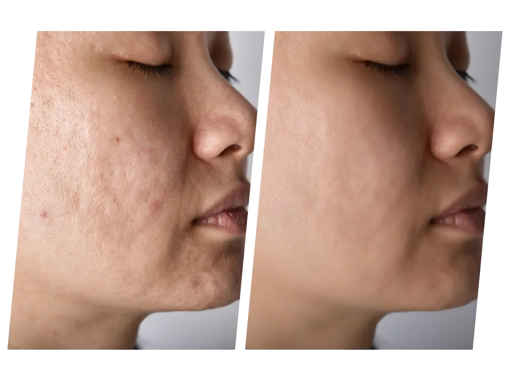 uneven skin pigmentation aesthetic specialist