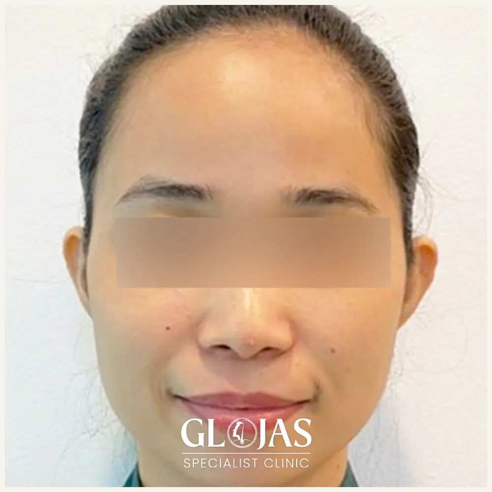 aesthetic clinic malaysia skin treatment kuala lumpur 1