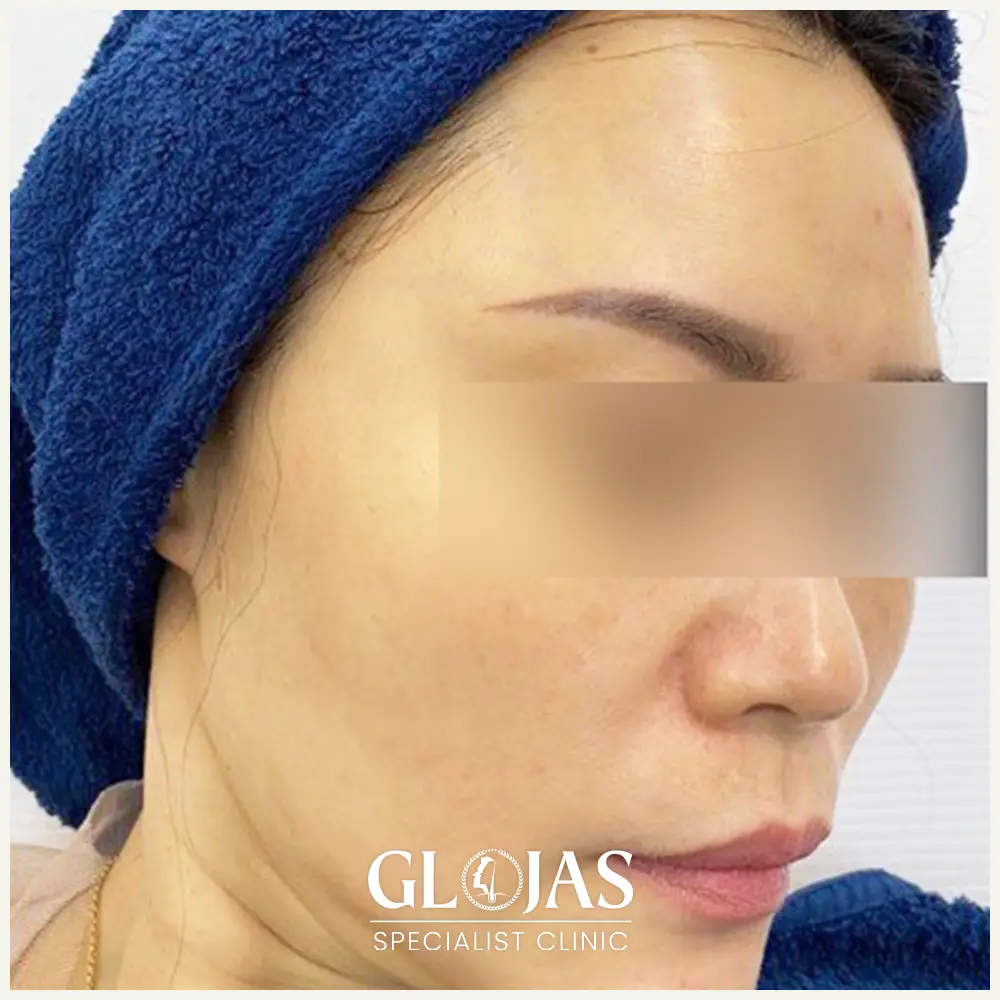 aesthetic clinic malaysia skin treatment kuala lumpur 7