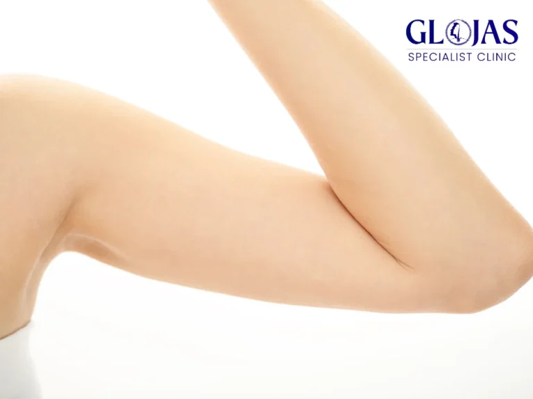 arm-liposuction