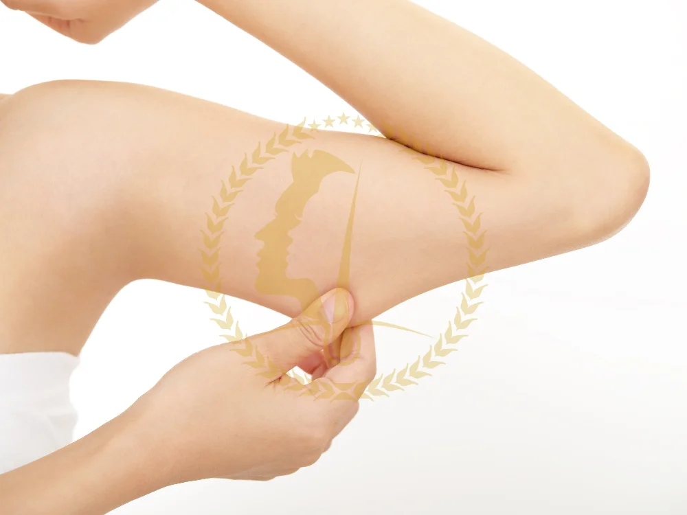 arm-liposuction