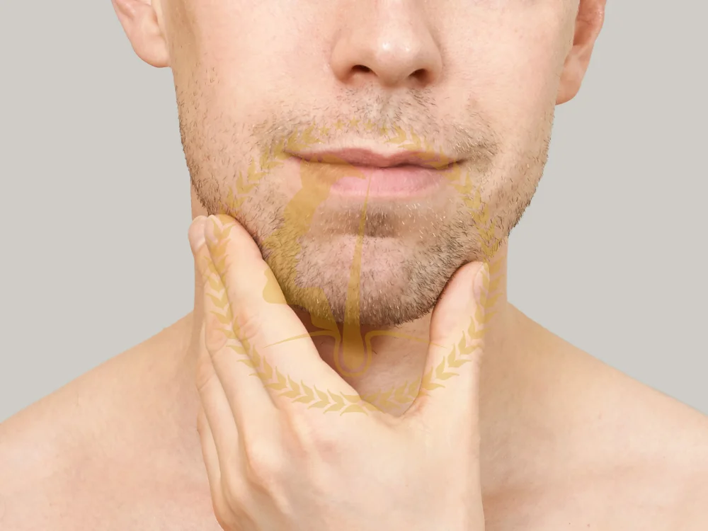 chin-liposuction