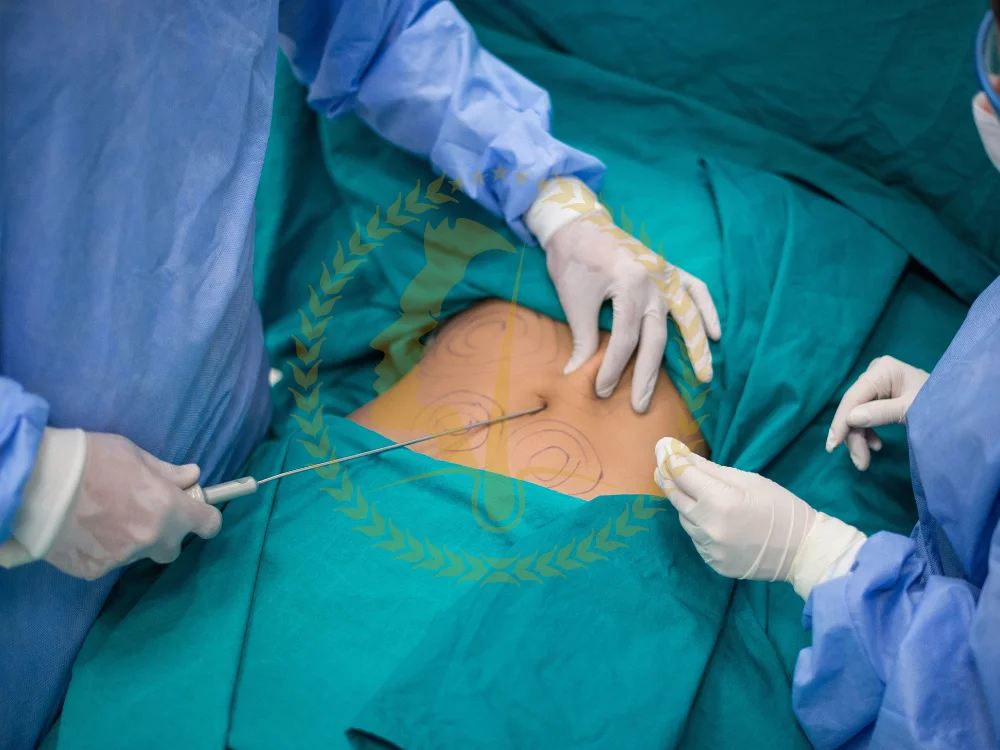 liposuction-cost