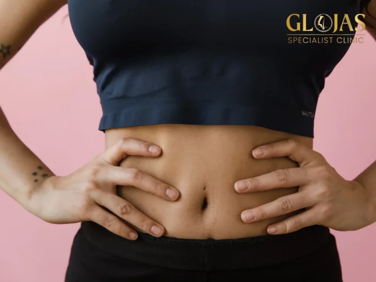 stomach-lipo