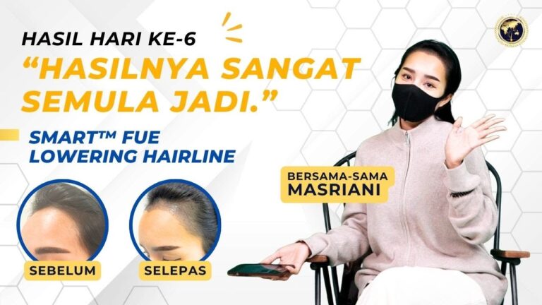 tanam-rambut