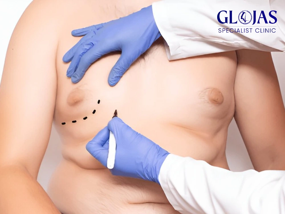 gynecomastia,gynecomastia-malaysia,gynecomastia-klinik,gynecomastia-glojas