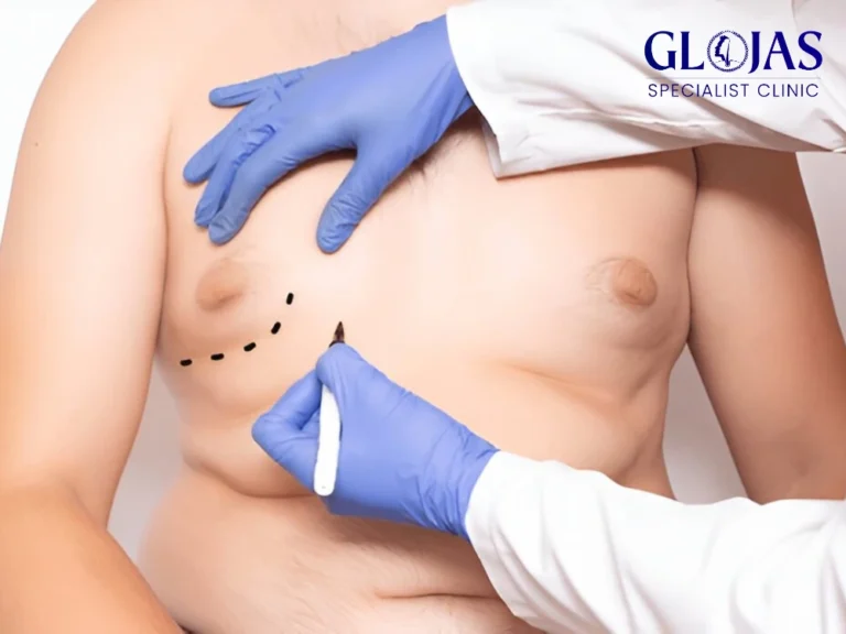 kos-pembedahan-gynecomastia-glojas,kos-pembedahan-gynecomastia-malaysia,kos-pembedahan-gynecomastia-klinik,kos-pembedahan-gynecomastia