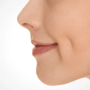 plastic surgery malaysia reconstructive medical center dimple creation