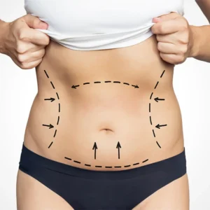 plastic surgery malaysia reconstructive medical center liposuction