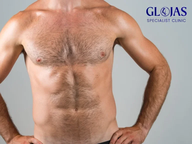 chest-hair-transplant