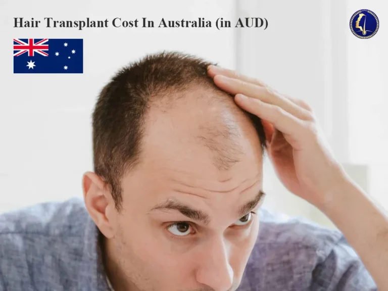 fue-hair-transplant-australia-cost-price-data-sydney-1