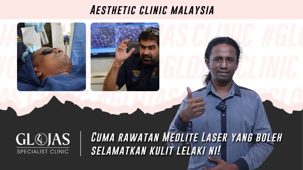 Medlite Laser Treatment: Kulit Jernih, Awet Muda