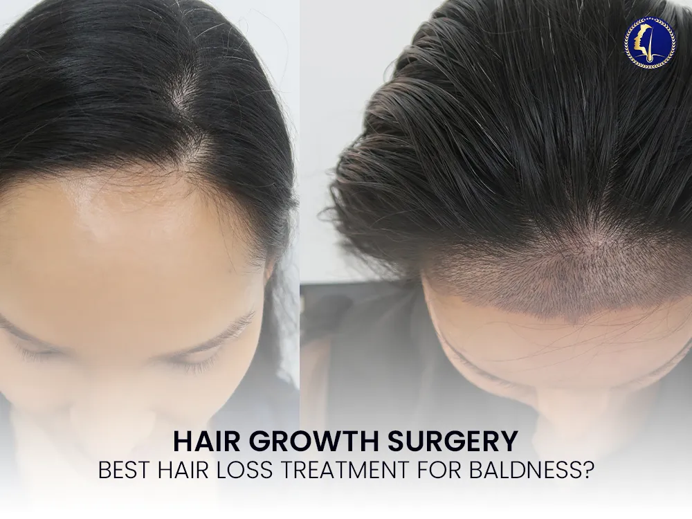 hair-growth-surgery-hair-loss-treatment-2025-before-after