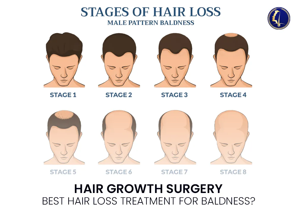 hair-growth-surgery-hair-loss-treatment-2025-men-baldness