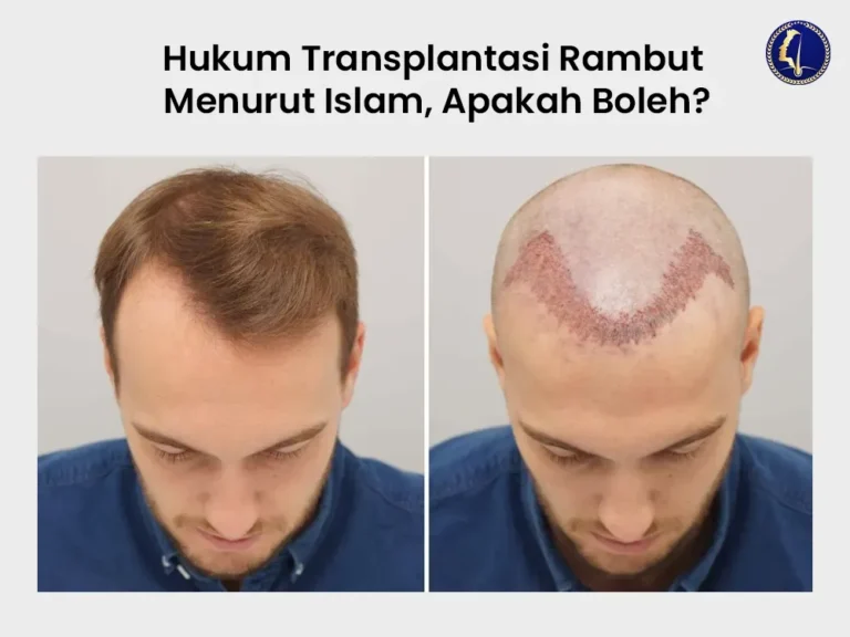 hukum-transplantasi-rambut-islam-indonesia-hair-transplant-malaysia