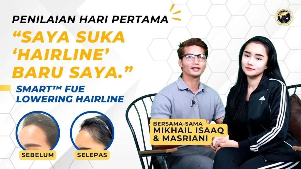 lowering-hairline-ulasan-hari-pertama.