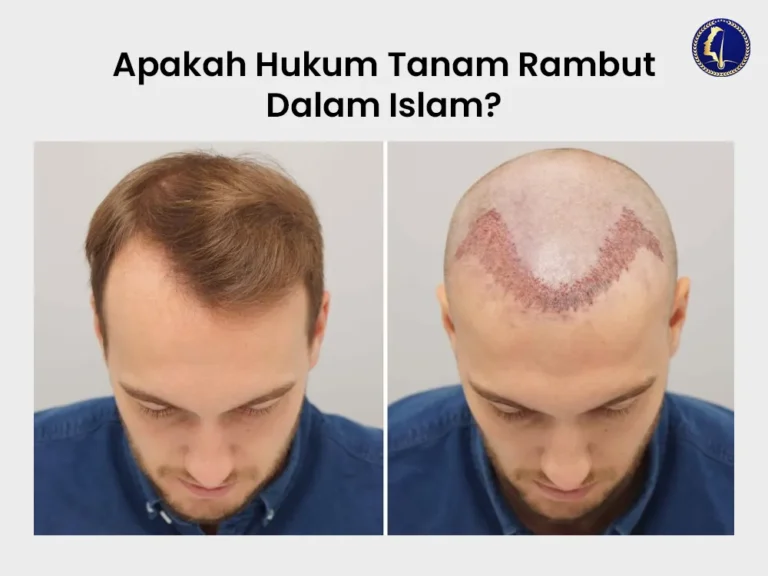 tanam-rambut-hukum-dalam-islam-hair-transplant-malaysia