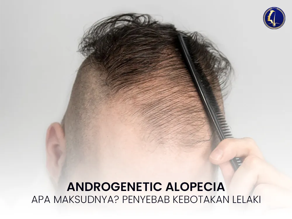 androgenetic-alopecia