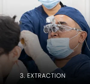 hair transplant malaysia extraction 2