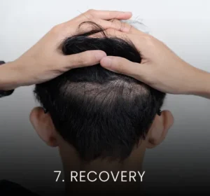 hair-transplant-malaysia-recovery