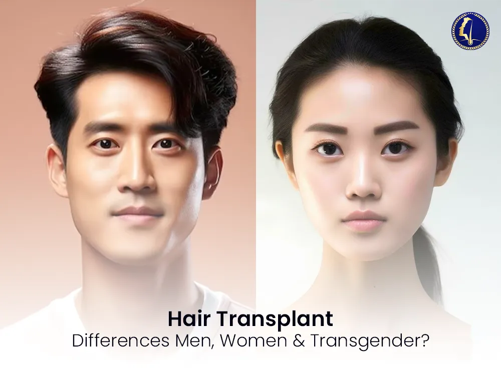 hair-transplant-men-women-transgender