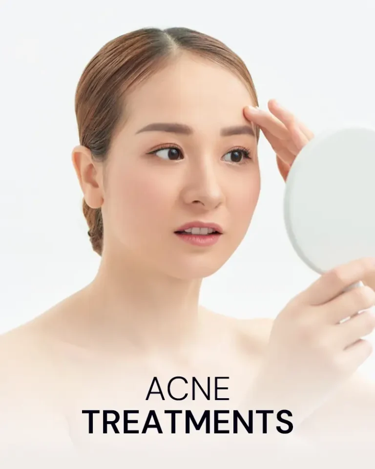 acne-treatments-medication