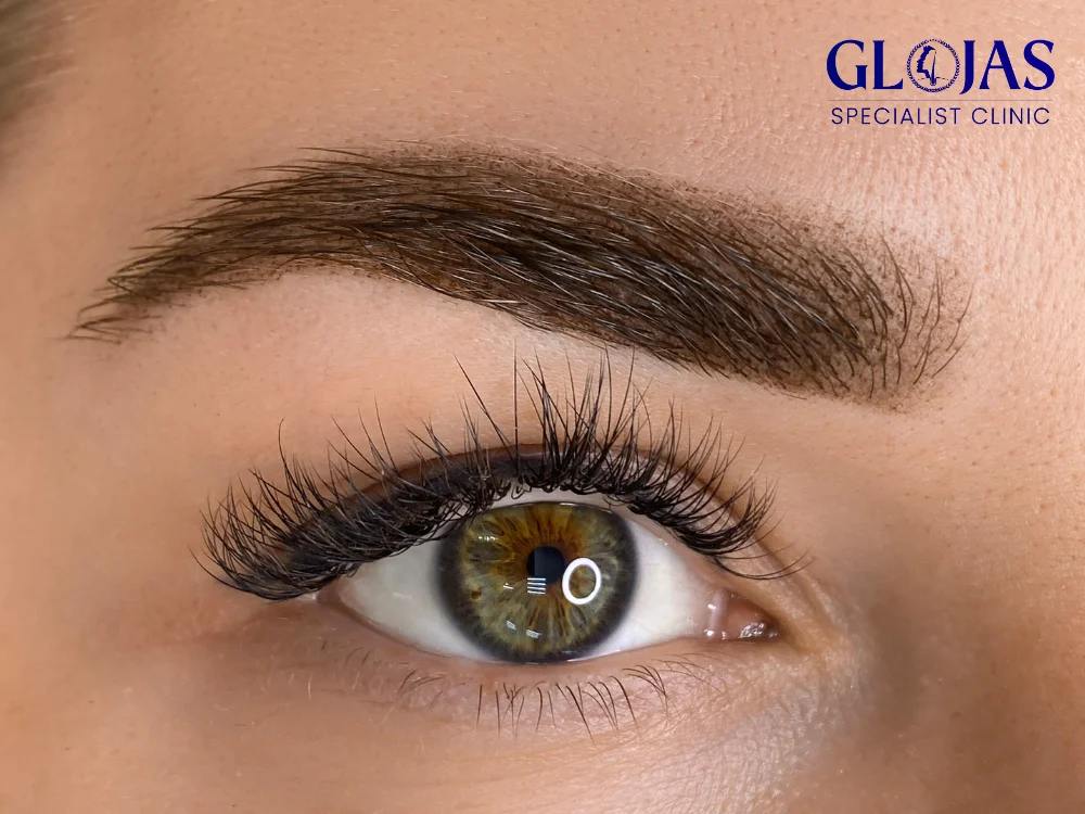 eyebrow-hair-transplant