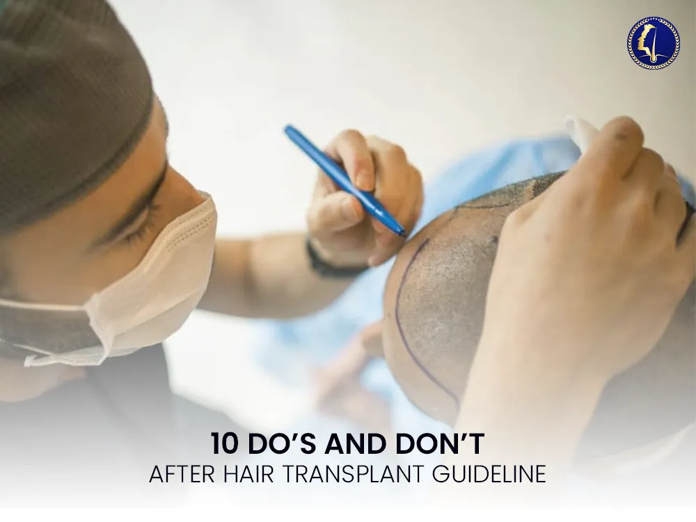 hair-transplant-dos-dont