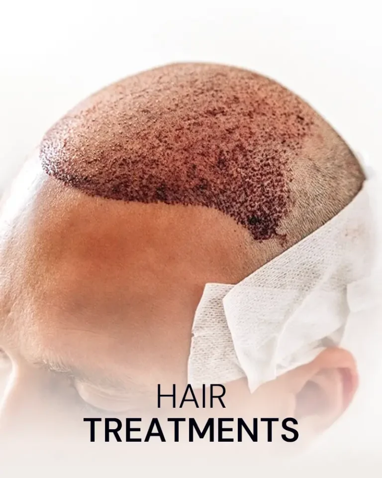 hair-transplant-malaysia-kl-pj-hair-restoration