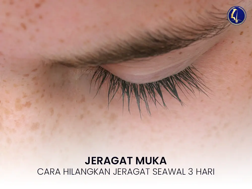 jeragat-muka-cara-hilangkan-1