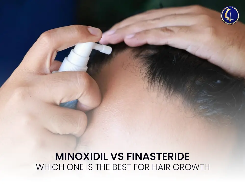 minoxidil-finasteride-malaysia-hair-growth-1