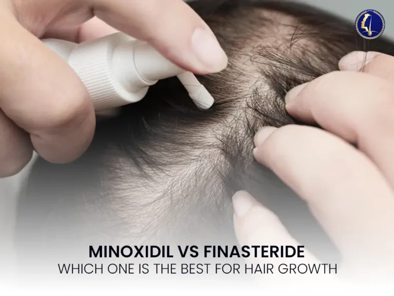 minoxidil-finasteride-malaysia-hair-growth