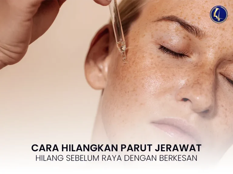 parut-jerawat-cara-hilangkan