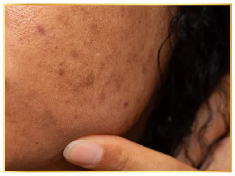 pigmentation-aesthetic-skin-treatments (2)