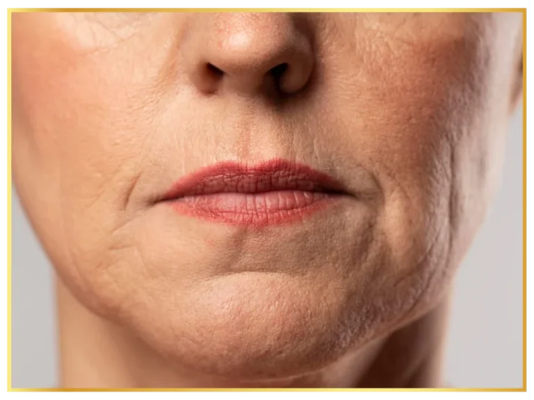sagging-skin-aesthetic-skin-treatments (4)
