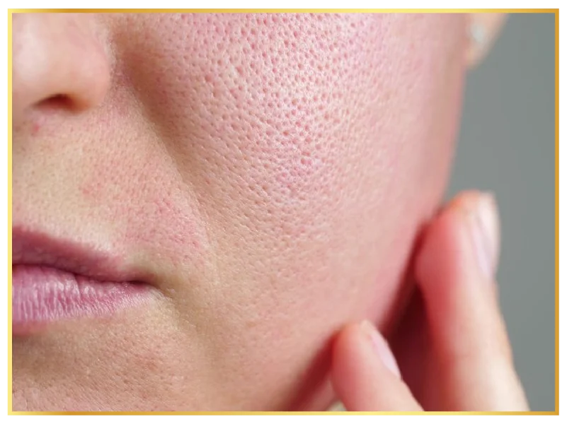 uneven-skin-texture-aesthetic-treatment