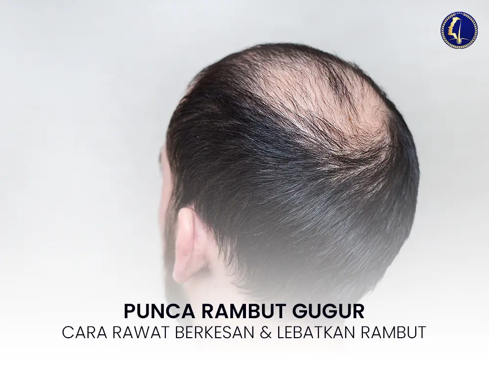 punca-rambut-gugur-cara-rawat-berkesan