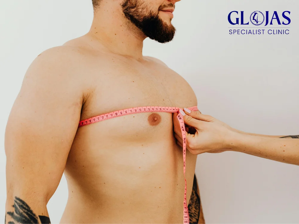 7 Effective Gynecomastia Treatment Options for a Confident You 1 gynecomastia-treatment
