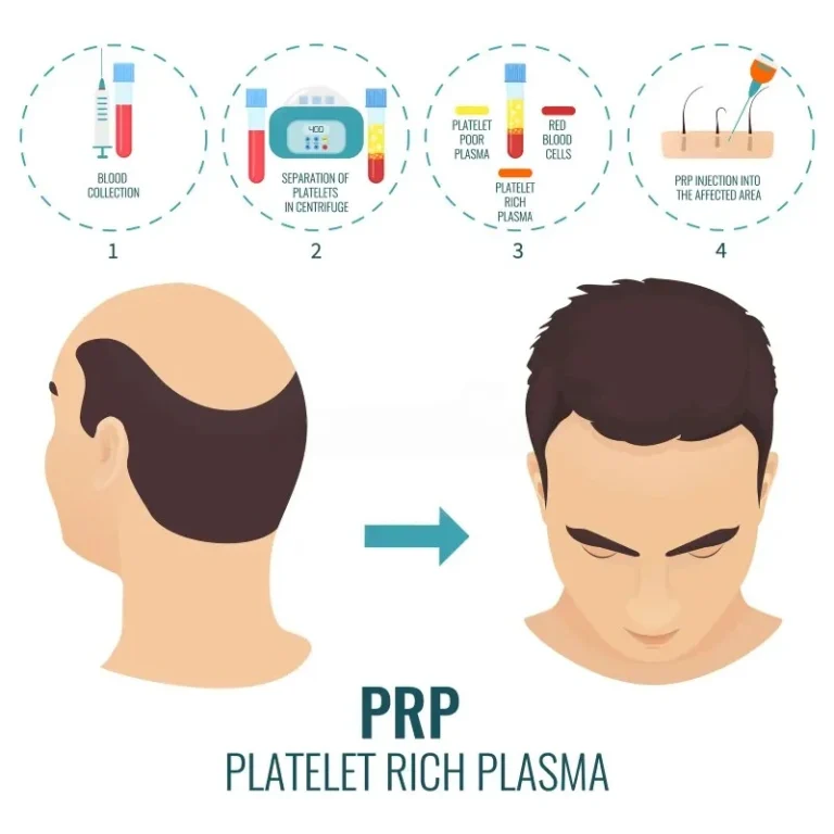 prp-treatment-malaysia