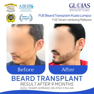 Gl HAIR poster p2 19 1