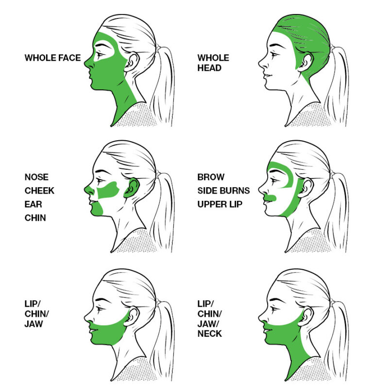 permanent-laser-hair-removal-kuala-lumpur-malaysia