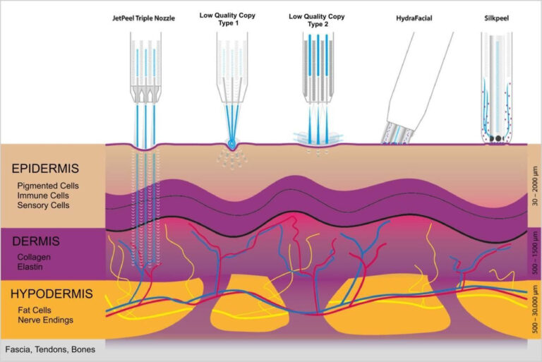 jet-peel-facial